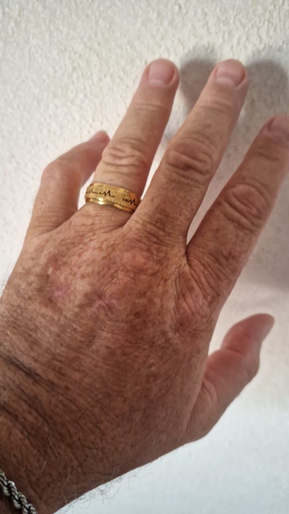 Imagem #2 deMarco A.